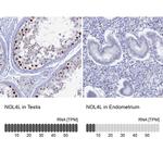CT112 Antibody in Immunohistochemistry (IHC)