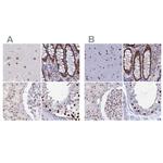 CT112 Antibody in Immunohistochemistry (IHC)