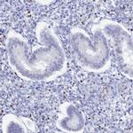 CT112 Antibody in Immunohistochemistry (IHC)