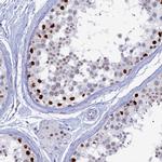 CT112 Antibody in Immunohistochemistry (IHC)