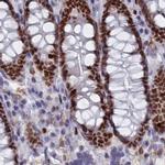 CT112 Antibody in Immunohistochemistry (IHC)