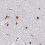 CT112 Antibody in Immunohistochemistry (IHC)