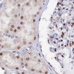 CT112 Antibody in Immunohistochemistry (IHC)