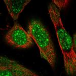 ZNF169 Polyclonal Antibody