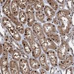 ZNF169 Antibody in Immunohistochemistry (Paraffin) (IHC (P))