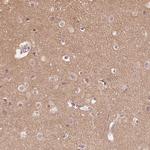 Cryptic Antibody in Immunohistochemistry (Paraffin) (IHC (P))