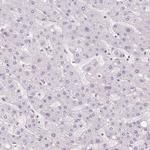Cryptic Antibody in Immunohistochemistry (Paraffin) (IHC (P))