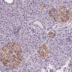 Cryptic Antibody in Immunohistochemistry (Paraffin) (IHC (P))