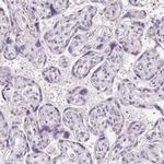 Cryptic Antibody in Immunohistochemistry (Paraffin) (IHC (P))