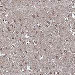 SNX32 Polyclonal Antibody