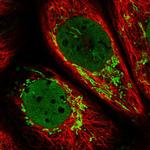 CARS2 Antibody in Immunocytochemistry (ICC/IF)