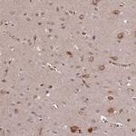 SLC38A7 Antibody in Immunohistochemistry (Paraffin) (IHC (P))