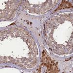 SLC38A7 Antibody in Immunohistochemistry (Paraffin) (IHC (P))