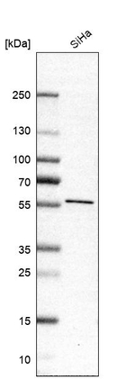 SLC38A7 Antibody in Western Blot (WB)