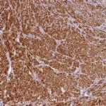 FUZ Antibody in Immunohistochemistry (Paraffin) (IHC (P))