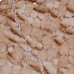 FUZ Antibody in Immunohistochemistry (Paraffin) (IHC (P))