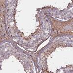 FUZ Antibody in Immunohistochemistry (IHC)
