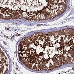 PGPEP1L Polyclonal Antibody