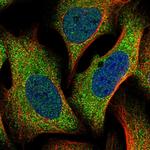 TTC31 Polyclonal Antibody