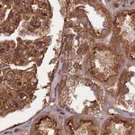 NULP1 Antibody in Immunohistochemistry (IHC)