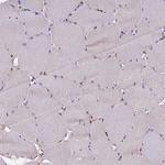 CLN5 Antibody in Immunohistochemistry (Paraffin) (IHC (P))