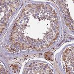 CLN5 Polyclonal Antibody