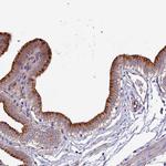 CLN5 Antibody in Immunohistochemistry (IHC)