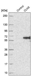 CLN5 Antibody in Western Blot (WB)