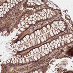 KPTN Polyclonal Antibody