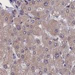 NUBP1 Antibody in Immunohistochemistry (IHC)