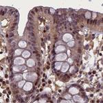 NUBP1 Antibody in Immunohistochemistry (IHC)