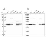 NUBP1 Antibody in Western Blot (WB)