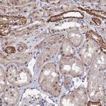 TSSC4 Antibody in Immunohistochemistry (Paraffin) (IHC (P))