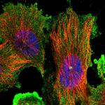 DIS3L Polyclonal Antibody