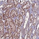 DIS3L Antibody in Immunohistochemistry (Paraffin) (IHC (P))