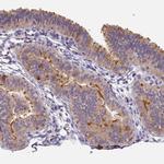 C15orf26 Polyclonal Antibody