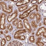 TBC1D1 Polyclonal Antibody