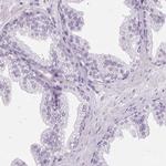 ROPN1L Antibody in Immunohistochemistry (IHC)