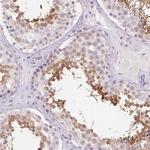 ROPN1L Antibody in Immunohistochemistry (IHC)