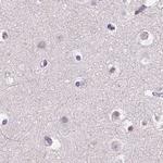 ROPN1L Antibody in Immunohistochemistry (IHC)