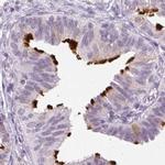 ROPN1L Antibody in Immunohistochemistry (IHC)