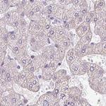 ROPN1L Antibody in Immunohistochemistry (IHC)