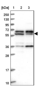 C15orf52 Antibody in Western Blot (WB)