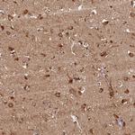 Katanin p80 Antibody in Immunohistochemistry (Paraffin) (IHC (P))