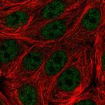 C19orf47 Polyclonal Antibody