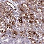 C19orf47 Antibody in Immunohistochemistry (Paraffin) (IHC (P))
