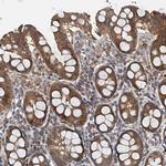 PPP1R14D Polyclonal Antibody