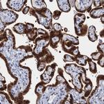 EPS8L1 Antibody in Immunohistochemistry (Paraffin) (IHC (P))