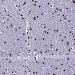 C19orf52 Antibody in Immunohistochemistry (Paraffin) (IHC (P))