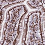 C19orf52 Antibody in Immunohistochemistry (Paraffin) (IHC (P))